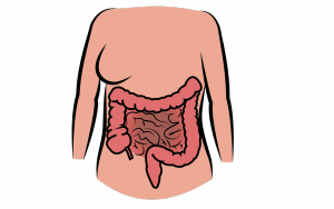 Infiammazione del colon