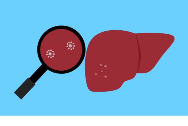 cura dell infiammazione del fegato