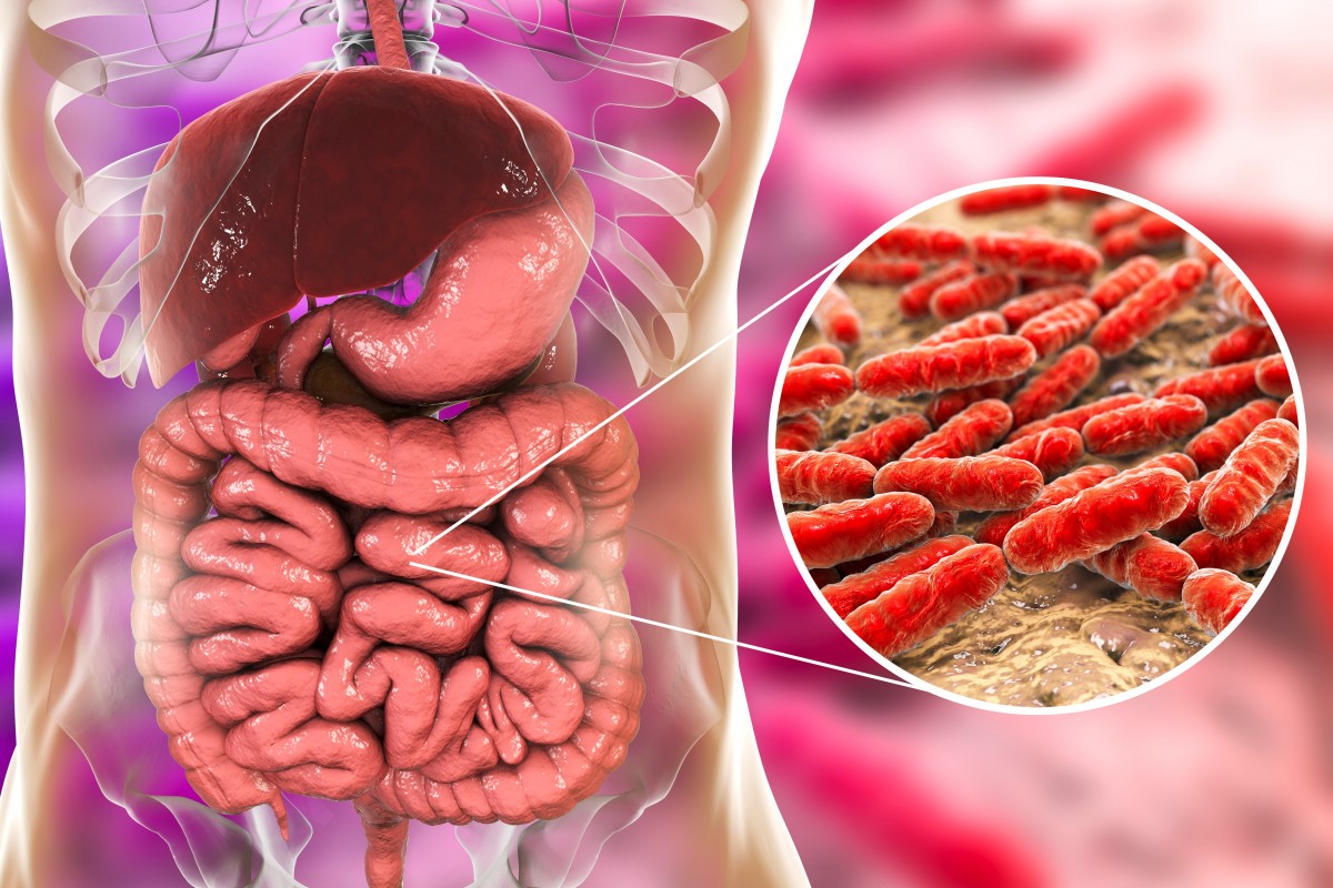 Disturbi intestinali come causa di infiammazione sistemica