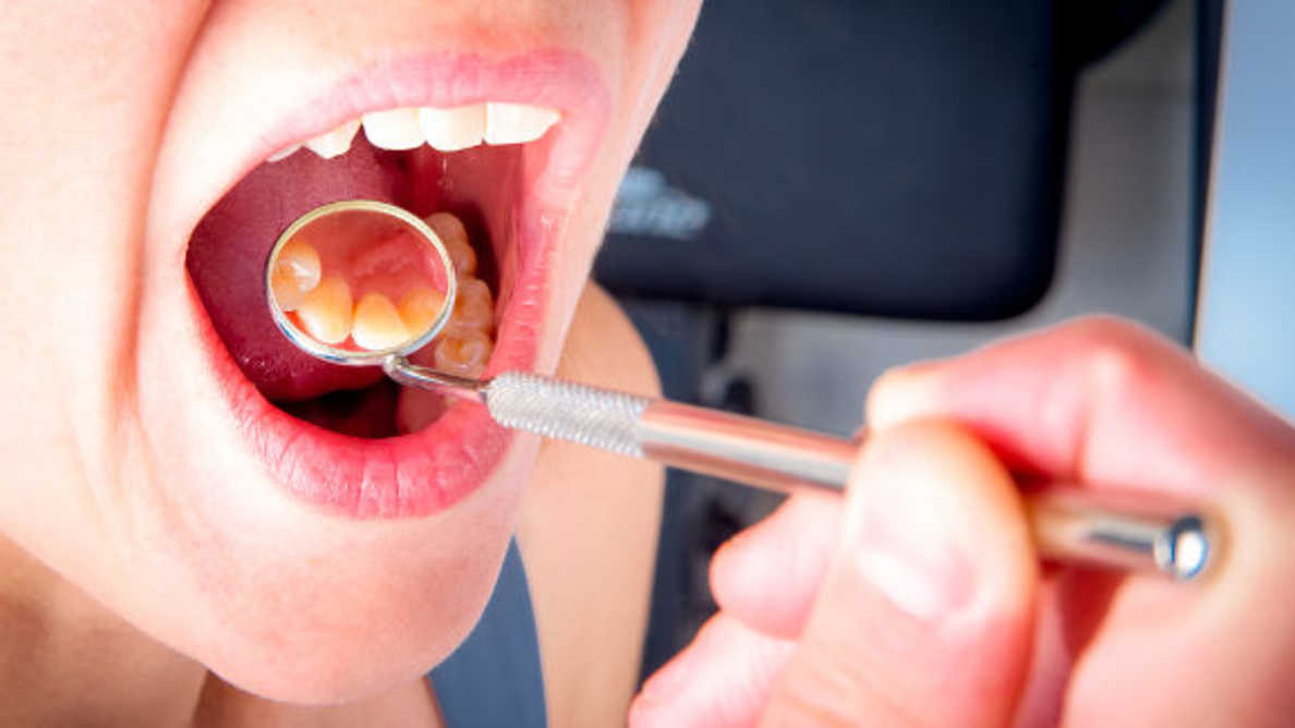 Il filo rosso che collega l’infiammazione orale e quella intestinale