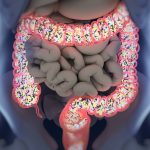 intestino